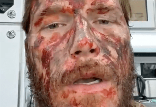 Chris Pratt UFC 264 prediction