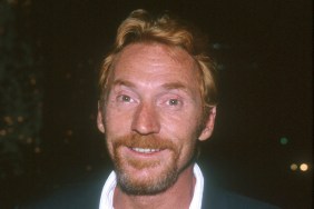 Danny Bonaduce Brain Surgery Scheduled After Actor Experiences Health Issues